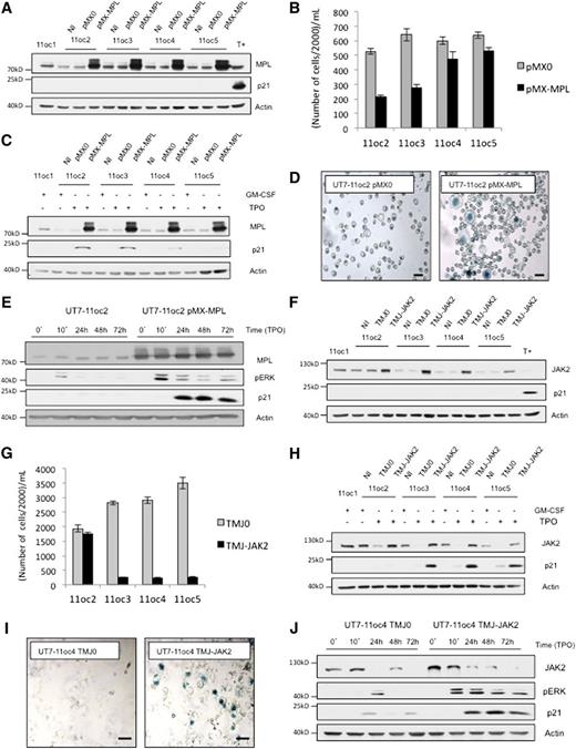 Figure 2. An increase in MPL or JAK2 expression, by viral transduction, according to the decreased protein expression, reinduces a proliferation arrest in the presence of TPO. (A) UT7-11oc2-5 clones were transduced with either empty retroviral vector (pMX0) or the vector encoding for MPL (pMX-MPL) and were cultured in the presence of GM-CSF. MPL and p21CIP1 protein expression were determined by immunoblotting. T+ corresponds to UT7-11oc1 cells exposed to TPO. (B) Cellular proliferation in presence of TPO. Cells were seeded at 20 000 cells/mL (D0) and counted at D5. (C) p21CIP1 expression was determined for cells exposed to TPO for 3 days, by immunoblotting. (D) SA-β-galactosidase staining in TPO-treated cells at D5. (E) After a 12 h cytokine starvation, UT7-11oc2 cells transduced with either the MPL-expression or control vector were stimulated with TPO. MPL, p21CIP1 expression and ERK phosphorylation status were then analyzed by immunoblotting. (F) UT7-11oc2-5 clones were transduced with either empty lentiviral vector (TMJ0) or the vector encoding for JAK2 (TMJ-JAK2) and cultured in presence of GM-CSF. MPL and p21CIP1 protein expressions were determined by immunoblotting. T+ corresponds to UT7-11oc1 cells exposed to TPO. (G) Cellular proliferation in the presence of TPO. Cells were seeded at 20 000 cells/mL and were counted at D7. (H) p21CIP1 expression was determined by immunoblotting for cells exposed to TPO for 4 days. (I) SA-β-galactosidase staining in TPO-treated cells at D5. (J) After a 12-hour cytokine starvation, UT7-11oc4 cells transduced with either the JAK2-expression or control vector were stimulated with TPO. MPL, p21CIP1 expression, and ERK phosphorylation status were then analyzed by immunoblotting. Bars: (D,I) 50 μm. Error bars represent standard deviations of 2 independent experiments. NI, noninfected cells.