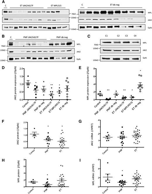 Figure 6. MPL/JAK2 mRNA and protein expression in platelets of MPN patients. Platelets were collected from patients diagnosed with PMF or ET, or from healthy donors (Controls C1 to C4). MPL/JAK2 protein expression was evaluated by immunoblotting for ET patients (A) and PMF patients (B) and was compared with normal controls (C). MPL/JAK2 protein expression, normalized with that of GpIb, was quantified using imageJ. (D) Quantification of JAK2 protein expression in platelets of MPN patients according to the MPL/JAK2 mutational status. (E) Quantification of MPL protein expression in platelets of MPN patients according to their MPL and JAK2 mutational status. (F) JAK2 protein expression and (G) JAK2 mRNA expression were determined for PMF an ET samples. (H) MPL protein expression and (I) MPL mRNA expression were determined for PMF and ET samples. Error bars indicate mean ± standard error of the mean. *P < .05; **P < .01.
