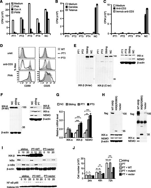 Figure 1. Contribution of IKKβ(R286X) mutation to CID. (A-C) Patients’ blood lymphocytes responded normally when stimulated with phytohemagglutinin (PHA) but had variably low responses to concanavalin A (Con A) and pokeweed mitogen (A). However, they failed to respond when stimulated with candida and tetanus antigens (B) or soluble or immobilized anti-CD3 (C). (D) Impaired upregulation of T-cell activation markers in patients’ CD4 T cells after overnight stimulation with plate-bound anti-CD3 or phytohemagglutinin. (E-F) Neither full-length nor truncated mutant IKKβ(R286X) protein is detectable in patients (PT), siblings, and normal peripheral blood mononuclear cells (E) and EBV-transformed B cells (F) by immunoblotting analysis with anti-N- and anti-C-terminal IKKβ antibodies. (G) mRNA levels of IKKα, IKKβ, and NEMO in PMCs detected by real-time quantitative polymerase chain reaction. (H) IKKβ(R286X) is not able to form a complex with IKKα/NEMO. Cell lysates from Phoenix-Eco cells transfected with Flag-tagged-FL-IKKβ, Flag-tagged-IKKβ(R286X), or vector control were subjected to immunoblotting analysis directly (left) or after immunoprecipitation with anti-Flag antibody conjugated agarose beads (right). (I) Defective IκBα/NFκB signaling in patient-derived B cells can be reverted by full-length (long) but not mutant IKKβ(R286X). EBV-transformed B cells of a sibling and patients stably infected with retrovirus expressing WT IKKβ or with control vector were rested in phosphate-buffered saline at 37°C for 30 minutes, followed by PMA stimulation for 10 and 20 minutes. Immunoblotting analysis of cytosolic fractions (top) or nuclear extracts (bottom) with indicated antibodies. (J) Decreased expansion of patient-derived B cells can be corrected by full-length but not mutant IKKβ. *P < .05; **P < .01; ***P < .001 determined by Student t test.