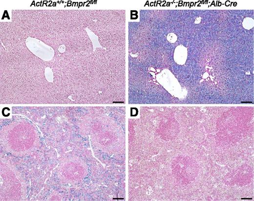Figure 4. Iron accumulation in ActR2a−/−;Bmpr2fl/fl;Alb-Cre mice. Livers (A-B) and spleens (C-D) from ActR2a+/+;Bmpr2fl/fl (A,C) and ActR2a−/−;Bmpr2fl/fl;Alb-Cre (B,D) mice were fixed in formalin, paraffin embedded, sectioned, and stained with Prussian blue. Sections were prepared from at least 4 animals in each group, and representative photomicrographs are shown. Scale bars represent 100 µm.