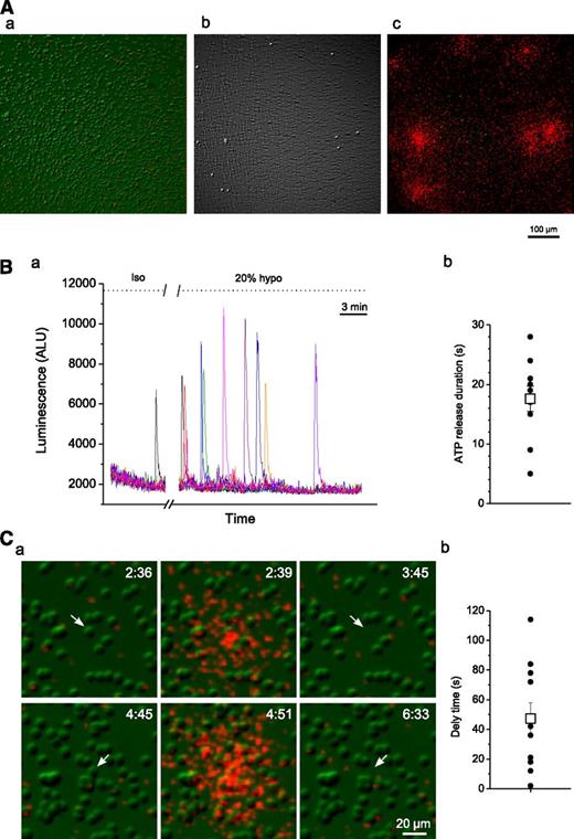 Figure 2. Luminescence imaging of ATP release from RBCs. (A) Image a is an IR-DIC image of RBCs before hypotonic shock application. Image b was obtained by subtracting control image a (before hypotonic shock) from that acquired ∼25 minutes after 20% hypotonic shock. The resulting white dots correspond to cells that lysed and were missing in images captured after hypotonic stimulation. c is an overlay of image b and cumulative ATP-dependent luminescence (in red) observed during the entire experiment. Note that regions of ATP release coincide with spots where cells lysed. (B) (a) Time-course of luminescence responses due to lysis of single RBCs in the experiment shown in A. Luminescence responses were measured at individual release sites seen in A and are indicated by traces of different colors. See supplemental Movie 1 for the entire time course of ATP release. (b) ATP release durations for the responses depicted in a measured from the start of release until the luminescence response decayed to 1/e of its peak value (black circles). Average (±SEM) release time was 17.6 ± 2.1 seconds (white square). (C) (a) Two examples (upper and lower row images) illustrating ATP release due to lysis of single RBCs. IR images of RBCs (in green) are overlaid with extracellular ATP-dependent luminescence (in red). 20% hypotonic shock-induced ATP release (center image) occurs shortly before lysis/collapse of a single RBC (indicated by a white arrow; see also supplemental Movie 2). No ATP release from intact RBCs is evident. The elapsed time (minutes:seconds) is shown in the upper-right corner. (b) Average delay time between start of ATP release and cell lysis for the responses shown in B (black circles). Average (±SEM) delay time was 47 ± 10.6 seconds (white square).