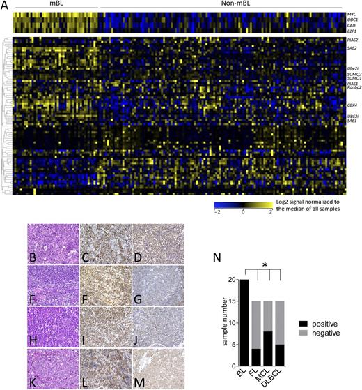 Figure 3. Activation of the SUMOylation pathways is a hallmark of human BL. (A) The expression of components of the SUMOylation pathway was analyzed in the gene expression data set GSE4475, comparing mBL with non-mBL samples.40 (B-M) Tissue microarrays of BL, DLBCL, mantle cell lymphoma (MCL), and follicular lymphoma (FL) were evaluated for SUMO2/3 expression using immunohistochemistry. (B) BL hematoxylin and eosin (H&E) staining. (C-D) BL SUMO2/3 positive. (E) FL H&E staining. (F) SUMO2/3-positive FL. (G) SUMO2/3-negative FL. (H) MCL H&E staining. (I) SUMO2/3-positive MCL. (J) SUMO2/3-negative MCL. (K) DLBCL H&E staining. (L) SUMO2/3-positive DLBCL. (M) SUMO2/3-negative DLBCL. Representative cases are shown. (N) Quantification of SUMO2/3 positivity in the indicated human B-cell lymphoma samples.