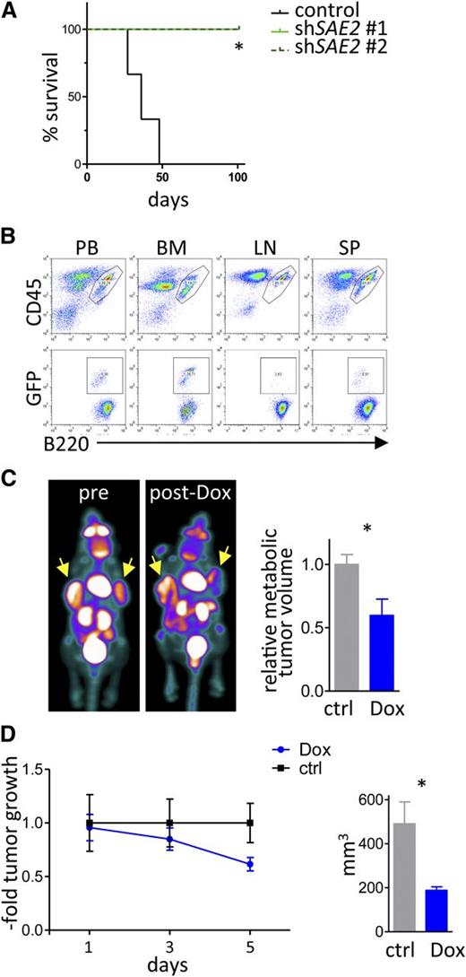Figure 7. Sae2 is required for maintenance of Myc-induced lymphoma in vivo. (A) Eµ-Myc lymphoma cells engineered to express shRNAs targeting Sae2 or a control shRNA as well as GFP were injected (20 000 cells IV) into syngeneic recipients (n = 3 control mice, n = 4 mice for each Sae2 targeting shRNA). Mice were followed for lymphoma onset. Shown is the disease-free survival. (B) After lymphoma onset, mice were euthanized and peripheral blood (PB), bone marrow (BM), lymph nodes (LN), and spleen tissue (SP) were harvested and analyzed for the indicated surface markers using flow cytometry. (C-D) Raji BL cells expressing the ecotropic receptor and rtTA were transduced with a retrovirus expressing Dox-inducible, miR30-based shRNA to silence SAE2 expression. A total of 10 × 106 cells were injected into the flanks of immunocompromised Nod/Scid mice (n = 8). Mice were followed for tumor onset, and a group of 4 mice was treated with Dox to induce the expression of the SAE2 shRNA. (C) FDG-PET imaging of human BL xenografts showing representative images (left) and quantification of metabolic tumor volume by FDG uptake (right) (n = 4 tumors for control, n = 6 tumors from mice treated with Dox). (D) Assessment of xenograft tumor growth (left) and size at end of experiment (right) during a 5-day ±Dox treatment period (n = 6 tumors for control mice, n = 8 tumors from mice treated with Dox).