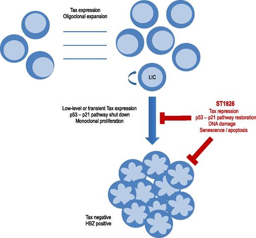 Schematic representation of ST1926 repression of Tax and apoptosis of ATL cells. Tax expression induces oligoclonal expansion of HTLV-1–infected CD4 T cells and deregulates signaling pathways including p53-p21 or DNA repair. ATL monoclonal proliferation occurs after decades of evolution in 2% to 7% of HTLV-1–infected patients. Cells having shut down Tax expression escape anti-Tax cytotoxic T lymphocytes and are preferentially selected. ATL cells have a Tax-negative and HBZ-positive phenotype. Transient or low-level Tax expression occurs, particularly in leukemia-initiating cells. ST1926 downregulates Tax expression and reactivates the p53-p21 signaling pathway. ST1926 induces massive and p53-independent apoptosis of leukemic cells.