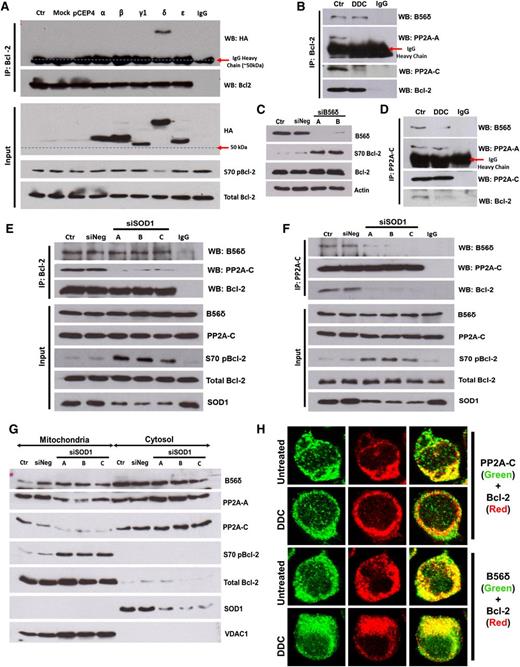 Figure 3. O2− augmented the level of S70pBcl-2 by inhibiting the holoenzyme assembly of PP2AB56δ. (A) Jurkat cells expressing hemagglutinin (HA)-tagged B56 family members (α, β, γ1, δ, and ε isoforms) were subjected to co-IP analysis using Bcl-2 as bait and IB for the indicated proteins. (B) Lysates from DDC-treated Jurkat cells were IP and IB with the indicated antibody (Ab). (C) Jurkat cells transfected with B56δ-specific siRNA (sequence A or B) were lysed and IB for the indicated proteins. (D-F) Lysates from DDC-treated or SOD1-silenced Jurkat cells were IP and IB using the indicated Abs. (G) Mitochondrial/cytosolic fractions from SOD1-silenced Jurkat cells were IB for the indicated proteins. The OMM protein VDAC1 served as a mitochondrial marker. (H) Confocal indirect immunofluorescence imaging of DDC-treated Jurkat cells. PP2A-C (left column) or B56δ (right column) is stained in green; Bcl-2 is stained in red. Colocalization of Bcl-2 and PP2A-C (left column) or B56δ (right column) appears yellow.