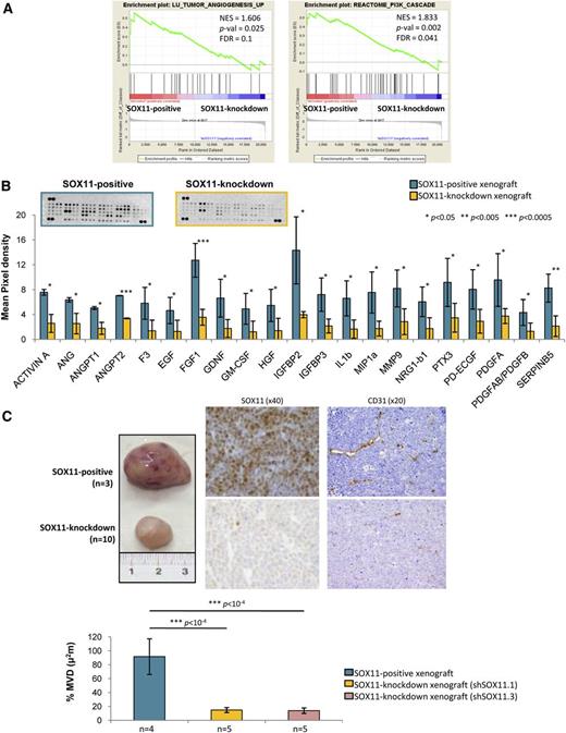 Figure 1. SOX11 induces the expression of proangiogenic factors and promotes angiogenesis in xenograft MCL-derived tumors. (A) GSEA analysis on expression data set from SOX11-positive and SOX11-knockdown xenograft tumors showing enriched gene sets related to angiogenesis pathways. NES, P-val, and FDR are represented. Statistical significance is considered when FDR <0.2. (B) Top panel, Representative images showing human-specific angiogenesis antibody array membranes incubated with protein extracts from SOX11-positive (n = 2) and SOX11-knockdown (n = 2) xenograft tissue lysates. Bottom panel, Quantification of the mean pixel densities showing 21 angiogenic proteins significantly upregulated in SOX11-positive compared with SOX11-knockdown xenografts. (C) Top panel, Macroscopic appearance and consecutive histological sections from representative SOX11-positive and SOX11-knockdown xenografts (Z138 shControl, n = 3; shSOX11.1, n = 5; and shSOX11.3, n = 5) stained with a specific antibody anti-human SOX11 (×40) and a specific antibody anti-mouse CD31 (×20). Bottom panel, Density (% of CD31-positive microvessel areas) of CD31-positive MVD areas in SOX11-positive and SOX11-knockdown tumors delineated by the presence of CD31-positive staining. Bar plot represents the mean percentage ± SD. P-val are shown. The significance of difference was determined by the independent samples Student t test. FDR, false discovery rate; NES, normalized enrichment score; P-val, P value.