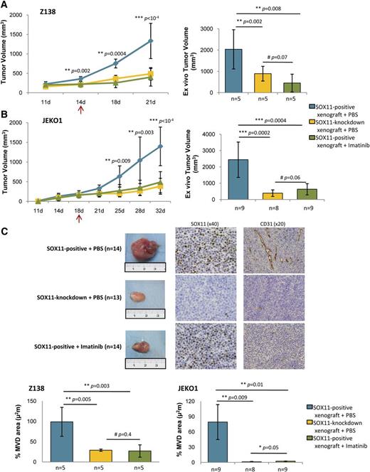 Figure 6. Imatinib reduces MCL tumor growth and angiogenesis of SOX11-positive MCL xenograft tumors. (A-B) Left panel, Tumor growth represented by tumor volumes (mm3) at the indicated days PI of Z138 and JEKO1 SOX11-positive xenografts treated with IP injections of imatinib (n = 5, n = 9) (green) or vehicle PBS (n = 5, n = 9) (blue) and SOX11-knockdown xenografts treated with IP of vehicle PBS (n = 5, n = 8) (yellow). Right panel, Graph displaying tumor volumes (mm3) at the time of tissue harvest, comparing imatinib (green) vs vehicle PBS (blue) treated SOX11-positive xenografts and (yellow) vehicle PBS-treated SOX11-knockdown xenografts. Compared with vehicle PBS, imatinib treatment significantly suppressed tumor growth of the SOX11-positive xenografts observed during follow-up (400 mm3 vs 1330 mm3, P < 1 × 10−4, and 490 mm3 vs 1400 mm3, P < 1 × 10−4 in Z138 and JEKO1, respectively) and ex vivo measurements (450 mm3 vs 2000 mm3, P = .008, and 630 mm3 vs 2400 mm3, P = .0004 in Z138 and JEKO1, respectively). (C) Top panel, Macroscopic appearance and consecutive histological sections from representative SOX11-positive (n = 14) and SOX11-knockdown xenograft tumors (n = 13) upon imatinib or vehicle PBS treatment. Immunohistochemical stainings were performed with a specific antibody anti-human SOX11 (×40) and an anti-mouse CD31 (×20). Bottom panel, Graph displaying the percentage of density of CD31-positive MVD areas in Z138 and JEKO1 xenograft tumors in (green) imatinib or (blue) vehicle PBS-treated SOX11-positive xenografts and (yellow) vehicle PBS-treated SOX11-knockdown xenografts, delineated by the presence of CD31-positive staining. Bar plot represents the mean percentage ± SD. P-val are shown. The significance of difference was determined by independent sample Student t test. PI, postinoculation.