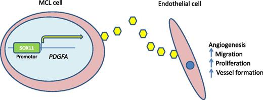 SOX11-PDGFA paracrine axis. SOX11 serves to transcriptionally regulate PDGFA. Secretion of PDGFA promotes angiogenesis to support lymphomagenesis. Inhibition of this pathway by agents such as imatinib mesylate may be an avenue for clinical trial investigation.