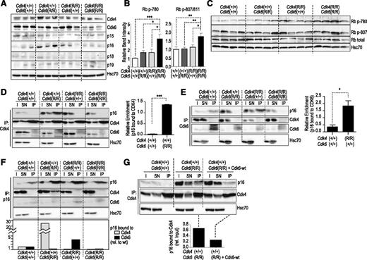 Figure 5. Biochemistry in p185BCR-ABL-transformed cell lines. (A) Expression levels of Cdk4, Cdk6, and INK family members in 3 individually derived cell lines of each genotype as indicated. (B) Phosphorylation of Rb at Ser780 or Ser807/811 is significantly increased in Cdk4R/R; Cdk6R/R as compared with single-mutant or control cultures. Depicted is the summary from 3 independent western blots using 3 or 4 independent p185BCR-ABL–transformed cell lines. *P < .05; **P < .01; ***P < .001. One-way ANOVA including Bonferroni’s multiple comparison test. (C) Representative blots of Rb phosphorylation in the indicated residues in 4 independent clones per genotype. (D) Protein levels of p16INK4a, Cdk4, and Cdk6 after immunoprecipitation (IP) with antibodies against Cdk4. I and SN indicate the input lysate or supernatant after IP. The relative enrichment of p16INK4a complexed with Cdk4 calculated from 2 individual IP experiments is shown in the histogram. Student t test; ***P < .001. (E) Protein levels of p16INK4a, Cdk4, and Cdk6 after IP with antibodies against Cdk6 (IP). I and SN indicate the input lysate or supernatant after IP. The histogram depicts the relative enrichment of p16INK4a complexed with Cdk6 calculated from 3 individual IP experiments. Student t test; *P < .05. (F) Protein levels of p16INK4a, Cdk4, and Cdk6 after IP with antibodies against p16INK4a. I and SN indicate the input lysate or supernatant after IP. The histogram shows the quantification (relative to wild-type cells) of the amount of p16INK4a bound to Cdk4 or Cdk6 in the different clones. (G) Overexpression of wild-type Cdk6 (Cdk6-wt) reduces the levels of Cdk4-bound p16 in Cdk4+/+; Cdk6R/R cells. In all of these assays, Hsc70 was used as a loading control.