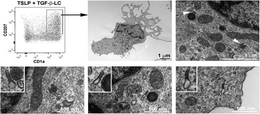 Figure 3. Birbeck granules on blood BDCA-1+ DCs treated with TSLP and TGF-β. After 3 days of culture with TSLP and TGF-β, blood BDCA-1+-derived LCs were sorted according to the expression of CD1a and CD207. Electron microscopy pictures show the presence of LC characteristic Birbeck granules in the cytoplasm (arrows). The Birbeck granules shown in the lower pictures correspond to different independent cells. The experiment was performed for 6 independent blood donors and found Birbeck granules in the CD1a+CD207+ cell population for all tested donors.