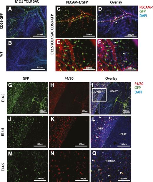 Figure 3. Immunofluorescence analysis of GFP expression during mouse development. (A-F) Whole-mount staining of yolk sacs from CD68-GFP (A,C-F) and WT (B) embryos at E12.5 to detect the presence of GFP+ cells (monocytes and macrophages) by immunofluorescence with an anti-GFP monoclonal antibody (green). Costaining with PECAM-1 (red), an endothelial cell marker, shows association of GFP+ cells with vessels (arrowheads in D,F). Nuclei are stained with DAPI (blue). (G-O) Frontal cryosections from CD68-GFP mouse embryos at E14.5. Immunofluorescence staining shows GFP+ cells (green) in the liver, heart, and thymus (G,J,M). F4/80+ cells (red) are abundant in the liver and thymus, but fewer F4/80 macrophages are seen in the heart at this stage in development (H,K,N). Arrowheads in panels L and O mark cells that are both GFP and F4/80 positive. Nuclei are stained with DAPI (blue).
