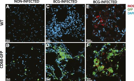 Figure 8. CD68-GFP macrophage BCG infection. BCG Pasteur was administered intranasally at 4 × 105 colony-forming unit to WT and CD68-GFP mice. After 4 weeks, mice were euthanized, and immunofluorescence analysis for transgene GFP expression in frozen lung tissue sections of naive (A-B) and BCG-infected (C-D) CD68-GFP and WT mice was performed. (E-F) Costaining with iNOS (red) was performed and showed strong association with endogenous GFP expression.