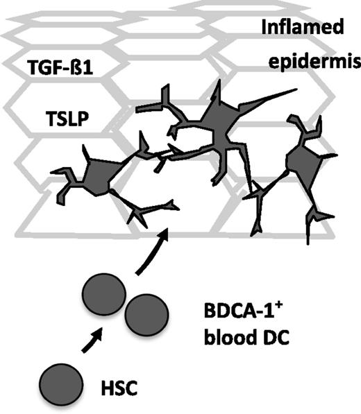 Hypothetical model of inflammatory LC differentiation. Epidermal keratinocytes express high levels of TSLP under inflammatory conditions. TGF-β1 is expressed by keratinocytes and was previously shown to promote LC differentiation. Martínez-Cingolani et al demonstrated that upon combined short-term stimulation with TSLP plus TGF-β1, human BDCA-1+ peripheral blood DCs acquire LC characteristics.1 They found that TSLP plus TGF-β1 synergistically promote LC differentiation from these cells. Whereas LCs undergo local proliferation in steady-state conditions, bone marrow–derived BDCA-1+ peripheral blood DCs may contribute to the pool of LCs during inflammation.