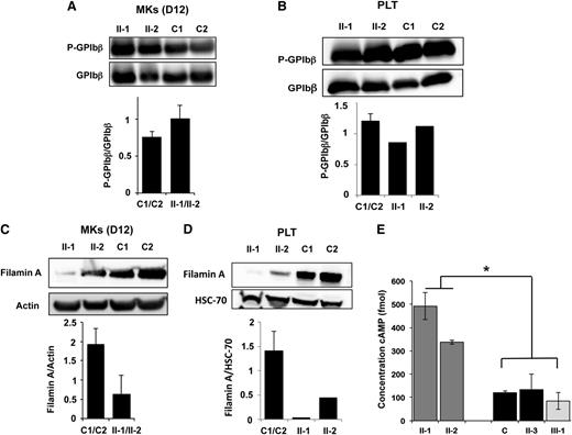 Figure 5. Analysis of PKA activity in patient platelets and megakaryocytes. (A-B) Western blot analysis and quantification of GPIbβ phosphorylated at Ser166 in MKs derived in vitro from (A) blood CD34+ progenitors and (B) in platelets of patients homozygous (II-1 and II-2) for the PRKACG p.74I>M mutation. Two external controls (C1 and C2) were analyzed. Total GPIbβ was used as a control of protein loading. MKs were investigated at (A) day 12 of culture. (C-D) Western blot analysis and quantification of filamin A in (C) MKs and (D) platelets of patients carrying the homozygous (II-1 and II-2) mutation. Two external controls (C1 and C2) were used. Actin or HSC70 was used as a control of protein loading. (E) Analysis of cAMP level in platelets isolated from one external (C1) and one internal control (II-3) and from 2 patients homozygous (II-1 and II-2) and 1 heterozygous for the PRKACG p.74I>M mutation (III-1). Error bars represent mean ± SD of triplicate. Experiments were performed 2 times with similar results. *P < .05, 2-tailed Mann-Whitney test.
