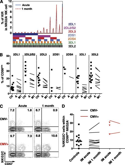 Figure 3. Frequencies of single KIR-positive and NKG2C+ CD56dim NK cells are not altered during acute IM. (A) Frequencies of CD56dim NKG2A− NK cells expressing the 7 analyzed KIRs from 1 representative CMV-seronegative IM patient at acute phase and at 1 month. The presence of 1 KIR in a combination is represented by a color code below the graph. (B) Frequencies of single KIR-positive CD56dim NK cells in healthy controls (Ctl, n = 11) and IM patients (n = 10) at acute phase (A) and at 1 month (M1). (C) Frequencies of NKG2C+ CD57+ NK cells within the CD56dim NKG2A− population from 1 CMV-seronegative and 1 CMV-seropositive IM patient at acute phase and at 1 month. (D) Frequencies of NKG2C+ NK cells within the CD56dim NKG2A− NK cell population in CMV-seronegative healthy controls (n = 13), CMV-seronegative (n = 10), and CMV-seropositive (n = 5, red) IM patients at acute phase and at 1 month (n = 2 for CMV-seropositive, red lines).