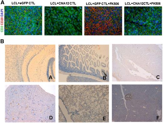 Figure 7. EBV-CNA12-CTLs infiltrate B-cell lymphoma despite the presence of FK506. (A) Tumors were collected 40 days post-CTL infusion and stained by double immunofluorescence for human T-cell infiltration (CD3 expression, green) into B-cell lymphoma (CD20, red). Tumors treated with CNA12-CTLs show a substantial T-cell infiltration despite the presence of FK506. Representative sections are shown at 100× magnification. (B) CN-resistant EBV-CTLs do not infiltrate and do not induce toxicity in organs. Organs were collected 40 days post-CTL infusion and stained for human T-cell infiltration (CD3 expression). Organs from mice treated with CNA12-CTLs do not show any T-cell infiltration in the brain (A), intestine (B), heart (C), kidney (D), lungs (E), or liver (F). Representative sections are shown at ×20 magnification.