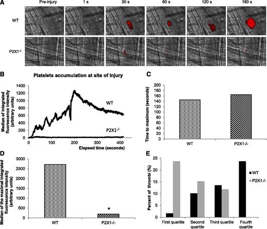 Figure 4. Platelet accumulation is reduced in P2X1−/− mice following a laser-induced injury on the cremaster. (A) Representative composite images of fluorescence and brightfield data depicting thrombus formation (in red) in WT (upper panel) and in P2X1−/− mice (lower panel). (B) The median of platelet-integrated fluorescence (y-axis) based on 29 thrombi was performed in 3 WT mice and 30 thrombi in 3 P2X1−/− mice and were represented over time. (C) The graph depicts the distribution of the time to acquire the maximal size for each thrombus in WT and P2X1−/− mice. NS (P < .05). (D) The graph depicts the maximal of integrated fluorescence intensity for each thrombus in WT and P2X1−/− mice. *P < .05. (E) The quartile distribution of the maximal integrated platelet fluorescence for each thrombus in WT and P2X1−/− mice. A total of 29 thrombi in WT mice and 30 thrombi in P2X1−/− mice were ranked, and the percentage of thrombi of each genotype was determined independently in each quartile of the rank order. Black bar, WT mice; gray bars, P2X1−/− mice.