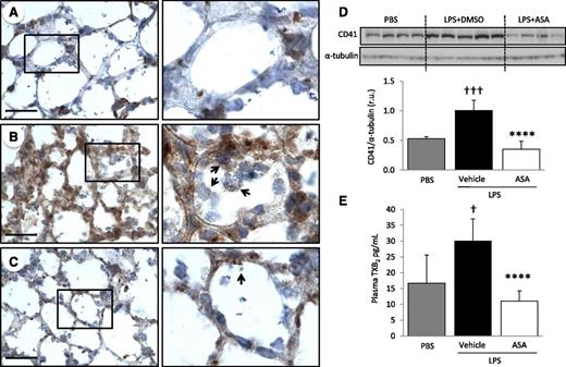 Figure 1. Platelets are sequestered and activated in the lungs after intratracheal LPS and ASA attenuates these responses. CD41 immunostaining of lung tissue sections from (A) control mice (PBS), (B) LPS-challenged mice treated with vehicle (DMSO), or (C) LPS-challenged mice treated with ASA. Images are representative of ≥3 animals per group. Original magnification, ×60; zoom of outlined areas. Scale bar = 20 µm. Arrows indicate CD41+ events in the intra-alveolar spaces. (D) CD41 protein expression and densitometric analysis from lung digestion samples in PBS controls and LPS-challenged mice ± ASA. †††P < .001 vs PBS; ****P < .0001 vs vehicle. (E) Platelet activation was assessed by measuring TXB2 plasma levels in PBS and LPS-challenged mice ± ASA. †P < .05 vs PBS; ****P < .0001 vs vehicle. Data are mean ± SD of 4 to 9 animals per group.