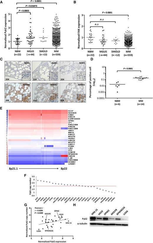 Figure 1. Pyk2 is highly expressed in MM. (A) Expression level of Pyk2 is significantly increased in MM patients (both smoldering MM and newly diagnosed MM) compared with healthy subjects (GSE2658). (B) Conversely, the FAK expression level is decreased in MM patients. (C) Expression of Pyk2 in BM biopsy specimens from MM patients (n = 14) and healthy donors (n = 6) was detected by immunohistochemistry staining. Three representatives in each group are shown (×20; ×100). All MM patients present with higher Pyk2 expression compared with healthy individuals. (D) Pyk2-positive cells in immunohistochemistry staining slides were quantified using ImageJ software. Three random fields at ×20 magnification were analyzed. (E) Based on analysis of the CCLE database, the copy numbers of genes harbored in the region from 8p21.1 to 8p22 are shown in the heatmap. U266 has significant loss of gene copy numbers, reflecting its 8p21 instability. (F) Pyk2 gene copy-number status of 27 MM cell lines enrolled in the CCLE database. (G) Based on analysis of the CCLE database, the Pyk2 mRNA level in MM cell lines is associated positively with its copy number (r = 0.7856; P = .032). (H) Pyk2 is expressed differentially in 6 MM cell lines using immunoblotting. Note that U266 cells express low to absent expression of Pyk2. NBM, normal bone marrow; SMOLD, smoldering MM.