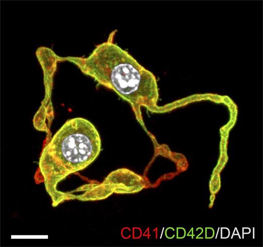 Representative confocal z-stack of diploid platelet-forming cells (DPFCs) showing proplatelet formation. E10.5 YS CD45−CD41high cells were cultured in serum-free medium with thrombopoietin for 72 hours. Cultures were stained with anti-CD41 and anti-CD42D antibodies. Nuclei were stained with 4,6-diamidino-2-phenylindole (DAPI). Scale bar represents 10 μm. See Figure 1H in the article by Potts et al that begins on page 2725.