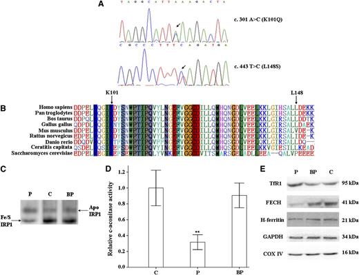 Figure 1. Characterization of the GLRX5 mutations and functional studies in PBMCs of a healthy control, the patient, and the patient’s brother, who is heterozygous for the K101Q mutation. (A) Two compound heterozygous missense mutations were identified in the GLRX5 gene. (B) K101 is highly conserved from yeast to humans, whereas L148 in GLRX5 is conserved in Drosophila, zebrafish, chickens, and higher mammals and is replaced by amino acids with similar properties in mouse and rat. (C) Determination of IRP1 status by nondenaturing polyacrylamide gel electrophoresis. A decreased Fe-S-IRP1 protein level was observed in PBMCs of the proband. (D) Relative cytosolic aconitase activity (results expressed as the mean percentage of the aconitase activity in the PBMCs of the healthy control). (E) Western blotting of TfR1, H-ferritin, and FECH. Equal loading was confirmed by showing that COX IV and glyceraldehyde-3-phosphate dehydrogenase (GAPDH) levels were unchanged. C, healthy control; P, patient; BP, patient's brother.