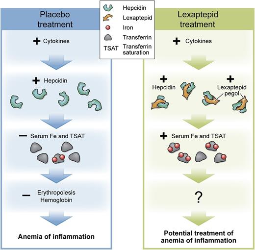 Effects of placebo or lexaptepid treatment on inflammatory-mediated hepcidin induction and systemic iron homeostasis. With placebo, acute or chronic inflammations as well as neoplastic disease cause an induction of cytokines. Cytokines, in turn, induce the expression of the iron-regulatory hormone hepcidin. Hepcidin degrades the iron-export channel ferroportin, so that hypoferremia develops. Erythropoiesis and hemoglobin levels decrease. Anemia of inflammation ensues. Patients treated with lexaptepid show the same induction of cytokines. Hepcidin is induced but bound by lexaptepid. The hepcidin-lexaptepid complex is biologically inactive and prevents hypoferremia. Therefore, lexaptepid might be a possible treatment of anemia of inflammation. The effects on erythropoiesis and hemoglobin levels have yet to be determined in clinical trials. TSAT, transferrin saturation. Professional illustration by XavierStudio.