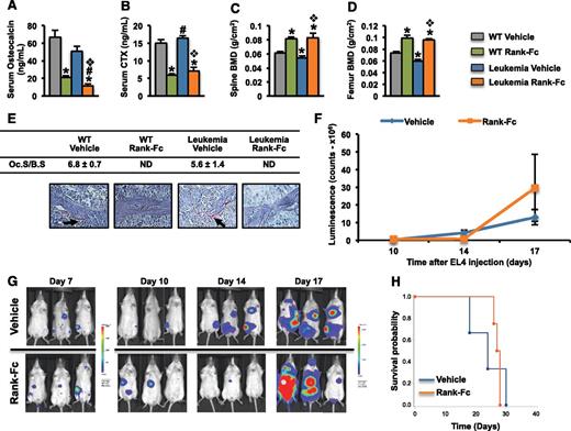 Figure 7. Osteoclasts do not affect leukemia progression. Albino C57BL/6 mice were treated at 2 months of age subcutaneously with 10 mg/kg of murine RANK-muFc or vehicle 3 times per week. In leukemic animals, the treatment started 2 days prior to EL4 cell injection and continued until the time of death. Healthy mice were treated for 4 weeks. Serum levels of osteocalcin (A) and C-telopeptide (CTX) (B), and bone mineral density (BMD) at the spine (C) and femur (D) in WT and leukemic mice treated with either RANK-Fc or vehicle. (E) TRAP+ osteoclasts (black arrows) in spine sections of WT and leukemic mice treated with RANK-Fc or vehicle. (F) Whole body luminescence counts. (G) Representative in vivo images showing leukemia progression. (H) Survival probability in mice injected with EL4 cells and treated with either RANK-Fc or vehicle (n = 4-7 mice per group). *, #,❖P < .05 (*, relative to WT vehicle; #, relative to WT LP533401; and ❖, relative to leukemia vehicle). ND, not detected.