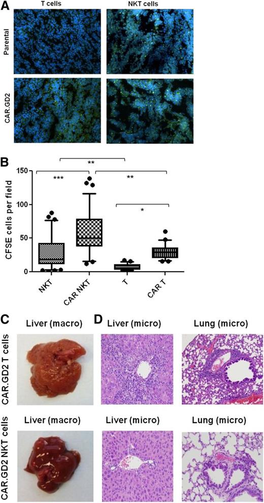 Figure 6. CAR.GD2 NKT cells effectively localize to the tumor site and do not induce GVHD in hu-NSG mice. (A) Tumor xenografts were established after injection of CHLA-255 NB cells under the renal capsule for 3 weeks followed by IV injection of CFSE-labeled parental or G28BBz-transduced NKT or T cells from the same donor. Mice were euthanized after 48 hours, and tumor sections were analyzed by fluorescent microscopy. (B) Multiple random fields of tissue slides were scanned from each tumor, and the absolute numbers of CFSE-labeled cells were counted using the NIS Elements AR3.2 software. Whiskers cover 10 to 90 percentiles. Mean ± SD from 5 to 10 fields per mouse, 5 mice per group from 1 of 2 independent experiments. *P < .05; **P < .01; ***P < .001, 1-way ANOVA with Bonferoni posttest analysis. (C) Animals were euthanized after 4 to 5 weeks of receiving cell therapy. Macroscopic evaluation shows significant swelling and granular transformation of liver in mice treated with CAR.GD2 T cells, whereas CAR.GD2 NKT cells had no effect on liver. (D) Microscopic examination shows lymphocytic infiltrates and necrosis in both liver and lungs of mice treated with CAR.GD2 T cells, whereas mice treated with CAR.GD2 NKT cells have no detectable abnormalities in the same organs. Shown are representative images from 1 of 3 experiments with similar results.