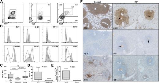 Figure 1. Splenic TFH phenotype and localization. (A) To determine splenic TFH percentage by FCM, CD3+CD4+ T cells were first gated within lymphocytes and then discriminated for CXCR5 expression. Within CXCR5+ T cells, the percentage of ICOS+PD-1hi cells was measured. (B) The expression of different markers was assessed on CD3+CD4+CXCR5+ICOS+PD-1hi (gray shaded histogram) and compared with CD3+CD4+CXCR5− (full line) and for some markers with B cells (dashed lined). Representative histograms of 1 ITP patient are depicted; the dotted line represents isotype control. Cells were stimulated for 5 hours with phorbol-12-myristate-23-acetate and ionomycin to determine CD154 expression, and in the presence of brefeldin A to measure IL-21 production. (C) CXCR4 expression was compared between CD3+CD4+CXCR5+ICOS+PD-1hi (TFHs), CD4+CXCR5−, and B cells. (D) The expression of IL-21R on TFHs was compared with CD4+CXCR5−. (E) TFH frequency within tonsils (n = 4) was compared with the one in the spleens (6 controls and 13 ITP patients). Data are depicted in box-and-whisker graphs. P value derived by Mann-Whitney test. (F) TFHs were localized by immunohistochemistry. Follicles and GC (arrowheads) were identified within the spleen by using CD20 staining. Then TFHs were identified by the expression of PD-1 (black arrows) and CD4 (white arrows). Representative spleens of 1 control and 1 ITP patient (magnification ×200).