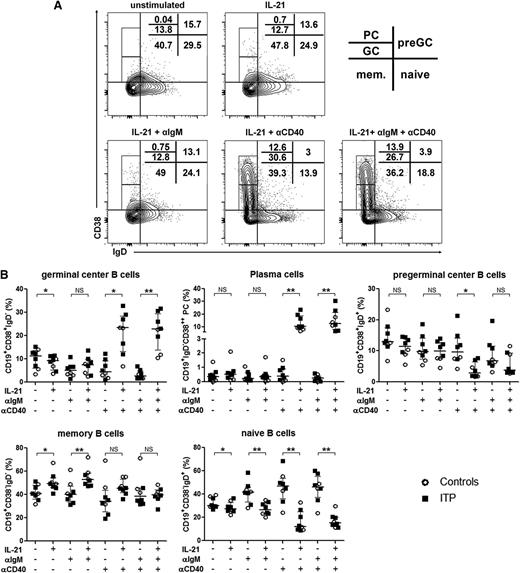 Figure 4. Role of IL-21 and CD40 ligation in splenic B-cell differentiation and total IgG production. Sorted splenic CD19+ B cells were stimulated with a combination of anti-IgM antibody (αIgM), anti-CD40 agonist antibody (αCD40), and IL-21. At day 6, cells were stained for the determination of B-cell subsets using CD38 and IgD expression. (A) Quantile contour plots of 1 representative ITP patient are depicted with the percentages of PCs and GC, preGC, memory (mem.), and naive B cells. (B) The effect of each stimulation alone or in combination on B-cell subsets is summarized in dot plots. Results obtained from 3 controls (open circles) and 5 ITP patients (black squares). P value derived by Wilcoxon matched-pairs test. The horizontal bar represents the median with interquartile range. P value derived by Wilcoxon matched-pairs test. NS, nonsignificant; *P < .05; **P < .01.