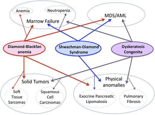 Figure 1. Overlapping and distinct clinical features of inherited marrow failure ribosomopathies. DBA, SDS, and DC are all characterized by marrow failure, predisposition to MDS/AML, and congenital anomalies. The primary feature of marrow failure in DBA is red-cell aplasia, although other hematologic lineages may also be variably affected. Although neutropenia is the most common feature of marrow failure in SDS, all 3 lineages may be depressed. Cellular and humoral immunologic abnormalities have been reported in DC and SDS. The spectrum of physical anomalies in these 3 syndromes shares both overlapping and distinct features.1 Exocrine pancreatic lipomatosis is characteristic of SDS, whereas pulmonary fibrosis is a common characteristic of DC. The risk of soft tissue sarcomas is increased in DBA, and the risk of squamous cell carcinomas of the oropharynx and gastrointestinal tract is elevated in DC. Data are insufficient to determine whether solid tumor risk is elevated in SDS. More detailed descriptions of clinical phenotypes have been reviewed.1