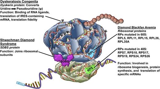 Figure 2. Mutations of key ribosome components underlying ribosomopathies. The DKC1 gene encoding dyskerin (rRNA pseudouridine synthase) is frequently mutated in X-DC. The SBDS gene encodes the SDBS protein and is found to be mutated in SDS. RP genes encoding ribosomal proteins belonging to both the large and small ribosomal subunits are found to be mutated in DBA.