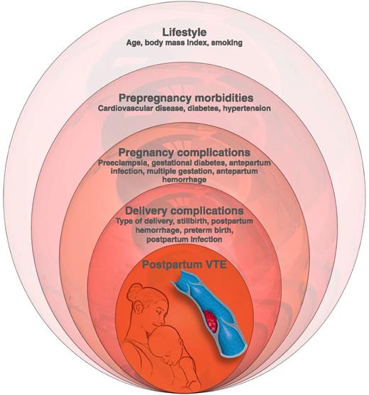 Conceptual model of levels of risk factors for postpartum VTE, based on hierarchical analysis used by Abdul Sultan et al. Professional illustration by Luk Cox, Somersault18:24.