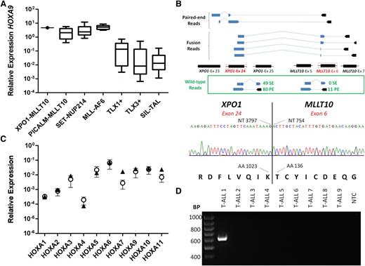 Figure 1. XPO1-MLLT10 fusion detected by RNA-sequencing is associated with deregulation of HOXA gene locus expression. (A) Expression of HOXA9 in genetic subgroups of T-ALL. Levels were determined by quantitative reverse transcriptase polymerase chain reaction (qRT-PCR) and calculated relative to an ABL housekeeping gene control. Boxes encompass the 25th through 75th percentiles, with the horizontal bar denoting the median expression level. Whiskers indicate the 10th and 90th percentiles. The numbers of cases tested in each group were as follows: XPO1-MLLT10, n = 1; PICALM-MLLT10, n = 36; SET-NUP214, n = 18; MLL-AF6, n = 9; TLX1+, n = 86; TLX3+, n = 67; SIL-TAL, n = 40. (B) Upper panel: Genomic mapping of the XPO1-MLLT10 fusion by poly(A)-enriched strand-specific RNA-sequencing using the SOLiD HQ5500xl system (Life Technologies). Mapping, coverage, and fusion discovery were determined by using LifeScope (Life Technologies), with reference to version hg19 of the human genome. A schematic representation of paired-end and fusion-spanning reads that revealed fusion between exon 24 of XPO1 (chr2:61708320-61708416) and exon 6 of MLLT10 (chr10:21901277-21901380) is shown. Solid lines indicate split reads spanning 2 exons, and dotted lines indicate 2 reads of the same fragment. The numbers of unique reads for the wild-type XPO1 (exons 24 and 25) and MLLT10 (exons 5 and 6) transcripts are also depicted. Lower panel: Confirmation of expression of an in-frame XPO1-MLLT10 fusion transcript by direct (Sanger) sequencing. The positions of the nucleotide (NT) and amino acid (AA) at the breakpoint of each gene are annotated. (C) Expression of HOXA genes in XPO1-MLLT10+ (n = 1; denoted by triangles) and PICALM-MLLT10+ (n = 4; mean levels denoted by circles with error bars indicating standard error of the mean) blasts. Transcript quantification was determined by qPCR using a TaqMan Low-Density Array, and the results of 2 experimental replicates were combined. Expression was calculated relative to a GAPDH housekeeping gene control. (D) RT-PCR for XPO1-MLLT10; 84 cases of HOXA+ T-ALL lacking known explicatory genetic anomalies were screened by using primers specific for the XPO1-MLLT10 fusion transcript (product size, 618 bp). A representative PCR result is shown. T-ALL 1 is the index XPO1-MLLT10+ case. NTC, no template control; PE, paired-end; SE, single-end.