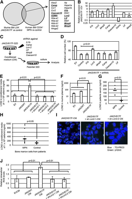 Figure 3. Lipocalin-2 secreted from JAK2V617F+ hematopoietic cells is associated with paracrine DNA damage. (A) Thorough investigation of genes with elevated expression in murine and human JAK2V617F+ hematopoietic cells compared with their normal counterparts in the published gene expression data (GSE21842 and GSE9827). Genes coding for soluble factors are underlined. (B) Quantitative real-time polymerase chain reaction (PCR) analysis of the candidate genes in JAK2V617F-32D cells relative to EV-32D cells (n = 3). (C) Schematic representation of the following experiments. JAK2V617F-32D cells were transduced with the shRNAs against candidate genes, and parental 32D cells were incubated with each CM. (D) Relative cell numbers of 32D cells 36 hours after incubation with each CM (n = 3 each). (E) Lipocalin-2 secretory ability in the respective 32D cells assessed by enzyme-linked immunosorbent assay (ELISA) in cultured media (n = 4 each). (F) Lipocalin-2 ELISA in the plasma of mice transplanted with EV, wild-type JAK2, or JAK2V61F-transduced bone marrow cells (n = 4 each). (G) Serum levels of lipocalin-2 in patients with MPNs. The concentration of lipocalin-2 for patients in complete remission for hematologic malignancies was measured as control. (H) Lipocalin-2 concentration of media conditioned by bone marrow mononuclear cells derived from patients with MPNs and controls. (I) Immunofluorescence staining of γH2AX foci formation (Alexa Fluor 488: green) in 32D cells incubated with CM from JAK2V617F-32D with shRNA against Lcn2 or control shRNA. Nuclei were stained with TO-PRO3. (J) Intracellular levels of ROS were measured by H2DCFDA assay following incubation of parental 32D cells with each CM for 24 hours. Average FITC fluorescence intensity is shown (n = 3 each). Scale bars: 10 μm. Error bars indicate SD.