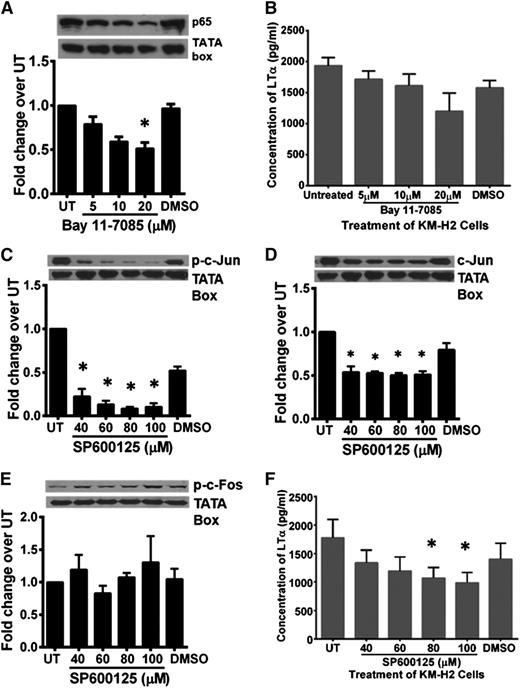Figure 5. Blocking of NF-κB and AP-1 pathways in HRS cells partially inhibited LTα production. (A) Western blot analysis and band density quantification showed reduced nuclear p65 expression in Bay11-7085–treated KM-H2 cells in a dose-dependent manner. (B) Treatment of KM-H2 cells with 3 different doses of Bay11-7085 as indicated resulted in reduced LTα production compared with untreated and DMSO-treated controls. (C-D) Western blot analysis and band density quantification showed reduction of phosphorylated and total c-Jun in SP600125-treated KMH2 cells. (E) Expression of phosphorylated c-Fos in these cells was unaffected. (F) KM-H2 cells treated with SP600125 showed reduced LTα production, with the most significant reduction observed when 80 and 100 µM of the inhibitor was used. Western blot shown is representative data of 3 independent experiments for A, C, and D and 2 independent experiments for E. The TATA box served as a nuclear protein loading control. β-Actin served as cytoplasmic protein loading control. Quantification of band density was carried out using ImageJ 1.48 software (National Institutes of Health). Density of the protein band for each condition was first normalized to respective loading control and then the fold change over untreated (UT) control cells was determined. Values shown are the mean ± standard deviation from 2 independent experiments for B and E and mean ± SEM from 3 different experiments for A, C, D, and F. *Statistical significance at P ≤ .05 compared with UT KM-H2 cells.
