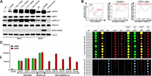 Figure 3. Functional characterization of the MAP2K1 mutants. (A) HEK293 cells were transiently transfected with expression plasmids encoding the indicated MAP2K1 and BRAF wild-type and mutant cDNAs, and corresponding lysates from cells maintained in serum were subjected to immunoblotting with the indicated antibodies. (B) Identification of functional implication of MAP2K1 mutations by IFC. Single cell suspension of LCH lesions were stained with Brilliant Violet (BV) 421-conjugated CD3, phycoerythrin (PE)-CD207, Alexa Fluor (AF) 488-phospho-MEK1, and AF647-phospho-ERK1/2 antibodies and analyzed by the gating strategy described in “Methods.” The top panels depict the distinctive CD3+ and CD207+ population sequestration (left) and overall p-MEK1+p-ERK1/2+ CD207+ (middle) or CD3+ (right) cells obtained by gating on 10 000 events. The middle and bottom panels show the representative images of random single cell events of 10 (138 through 2061) or 6 (308 through 4600) in CD207+ and CD3+ cells, respectively, identified by gating events with intermediate bright field (BF) area and BF aspect ratios close to 1. The indicated populations were then analyzed for coexpression of p-ERK1/2 or p-MEK1 in the CD207+ or CD3+ cells in the indicated channels. (C) Median fluorescent intensity (MFI) of p-MEK1 or p-ERK1/2 in CD207+ cells determined through IFC in patients harboring BRAFV600E (patients LCH5, LCH7, and LCH13) and MAP2K1 c.302_307del (patient LCH24) mutations, and patients with no somatic mutations (LCH30, LCH32, LCH37, LCH38, and LCH40).