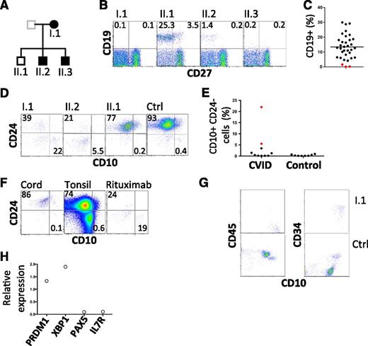 Figure 1. Flow cytometric analysis of B lymphocytes. (A) Pedigree with those affected shown in closed symbols. (B) Analysis of circulating B cells. CD19+ CD27− cells represent naive B cells; CD19+ CD27+ cells indicate memory B cells. (C) Summary of B-cell numbers relative to other CVID-affected patients. (D) Analysis of transitional B cells in family members. (E) Summary of CD10hi CD24lo cells in CVID patients and normal controls. I.1 and II.2 are indicated by red symbols. (F) Analysis of CD10 and CD24 expression by CD19+ cells obtained from cord blood, tonsil, and peripheral blood of a patient after treatment with rituximab. Plots are representative of 5 similar samples. (G) Bone marrow leukocytes of proband and control, gated on CD19+ cells to show CD10, CD45, and CD34. CD45+ CD10+ CD34+ cells are pro-B cells and CD45+ CD10+ CD34− cells are pre-B cells. (H) Expression of indicated transcripts in bone marrow aspirate from proband relative to their expression in 2 normal control marrows. Ctrl, control.