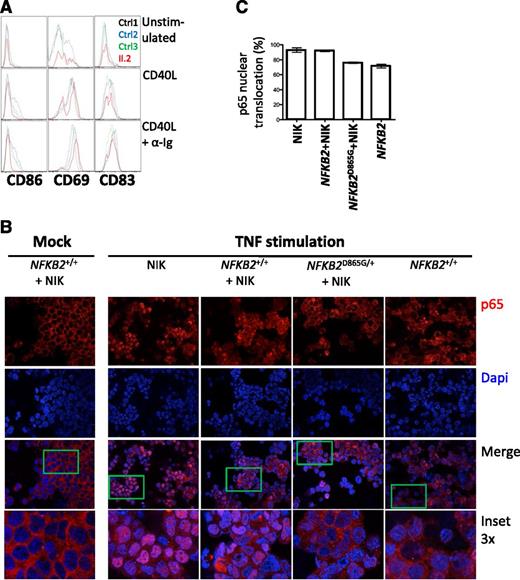 Figure 6. Defective canonical pathway activation in the presence of nonprocessable p100. (A) Analysis of B cells from II.2 relative to controls for expression of CD86, CD69, and CD83 after 24 hours of treatment with indicated stimuli. (B) Nuclear translocation of p65 (red) in HEK293 cells transfected with the indicated constructs after stimulation with TNF. A 4,6 diamidino-2-phenylindole counterstain identifies cell nuclei. (C) Summary of p65 translocation of immunofluorescence confocal.