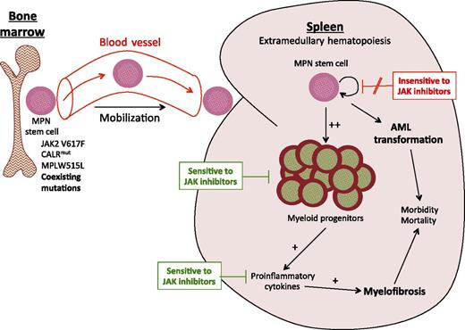 In MF, MPN disease-propagating stem cells aberrantly mobilize from the bone marrow to the spleen. Several independent sources of data, including the current study, indicate that JAK2-mutant MPN stem cells are not effectively targeted by JAK inhibition. The current study by Wang et al suggests that following treatment with a JAK inhibitor, MPN progenitor cells in the spleens of patients with MF undergo apoptosis resulting in a reduction in splenomegaly. JAK inhibitor clinical trial data indicate that circulating proinflammatory cytokine levels decrease following JAK inhibition. Whether suppressing the inflammatory milieu through JAK inhibition could potentially delay progression or even reverse MF within the bone marrow, without selectively targeting the malignant hematopoietic clone, remains to be determined.