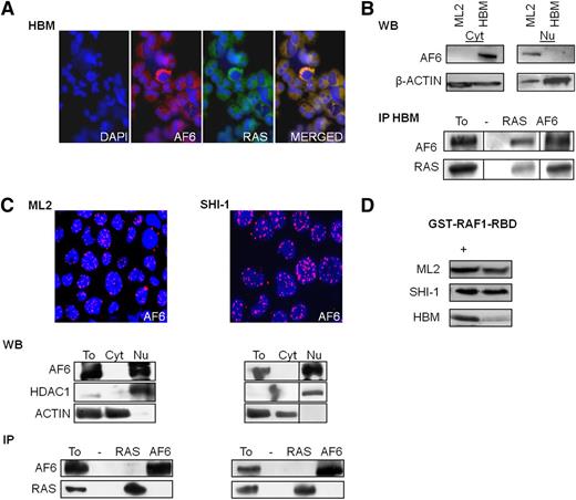 Figure 1. MLL-AF6 modifies AF6 localization from cytosol to nuclear. (A) AF6 colocalizes with RAS (merged) in cytosol of healthy bone marrow (HBM) cells: (left) immunofluorescence of HBM primary cells stained with DAPI and respective antibodies against AF6 and RAS (×20 zoom). (B) (Top) Western blot analysis (WB) of AF6 and RAS expression in cytoplasmic (Cyt) and nuclear (Nu) cell extracts. (Bottom) coimmunoprecipitation (IP) of AF6 and RAS in HBM cells. Total lysates (To) were used as positive controls; negative controls (−). (C) (Top) Nuclear localization of AF6 in ML2 and SHI-1 cell lines by immunofluorescence (AF6 red, nuclei stained with DAPI in blue, ×20 zoom). (Middle) WB of AF6 and RAS expression in total (To), cytoplasmic (Cyt) and nuclear (Nu) cell extracts; anti-HDAC1 and anti-ACTIN were used as endogenous controls for nuclear and cytoplasmic proteins, respectively. (Bottom) coimmunoprecipitations (IP) between RAS and AF6 showed no interaction between the 2 proteins in neither of t(6;11) leukemic cell lines. (D) Active RAS-GTP levels in ML2, SHI-1, and HBM cells; positive control (+). Vertical lines have been inserted to indicate repositioned gel lanes.