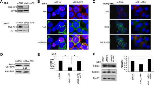 Figure 2. Silencing of MLL-AF6 in t(6;11)(q27;q23) rearranged cells restores AF6 in the cytoplasm. (A) Western blot (WB) analysis revealed decreased levels of MLL-AF6 after silencing (siMLL-AF6) compared with negative controls (scRNA) in both, ML2 and SHI-1. Anti-ACTIN was used as endogenous control. (B) The siMLL-AF6 cells restored AF6 protein in the cytoplasm. Immunofluorescence shows colocalization of AF6 (red) and RAS (green) in SHI-1 after MLL-AF6 silencing (merged signals, yellow, nuclei blue, ×60 zoom). In the negative control (scRNA), the punctuate pattern of AF6 nuclear localization is visible (red AF6, nuclei blue, ×60 zoom). (C) The siMLL-AF6 cells restored AF6 protein in the cytoplasm. Immunofluorescence shows colocalization of AF6 (red) and RAS (green) in primary t(6;11)-AML after MLL-AF6 silencing (merged signals yellow, nuclei blue, ×60 zoom). In the negative control (scRNA), the punctuate pattern of AF6 nuclear localization is visible (red AF6, nuclei blue, ×60 zoom). (D) Active RAS-GTP levels in ML2 cell line silenced for the chimera showed a decreased activity of RAS (0.47) compared with scRNA. (E) Luciferase (LUC) activity of ML2 transfected with a pFOS (FBJ murine osteosarcoma viral oncogene homolog) WT-GL3 plasmid and siMLL-AF6 show a reduction of LUC activity compared with scRNA. Introduction of both siRNA for MLL-AF6 and AF6 show a rescue of LUC activity in ML2. (F) WB of p-ERK1/2 and total ERK in ML2 silenced for MLL-AF6 and in double silencing of MLL-AF6 and AF6 compared with scRNA. (Right) Histogram represents the ratio between p-ERK and total ERK: a reduction of p-ERK is visible after MLL-AF6 silencing, and a rescue of p-ERK is documented when also AF6 was silenced. *P > .05.