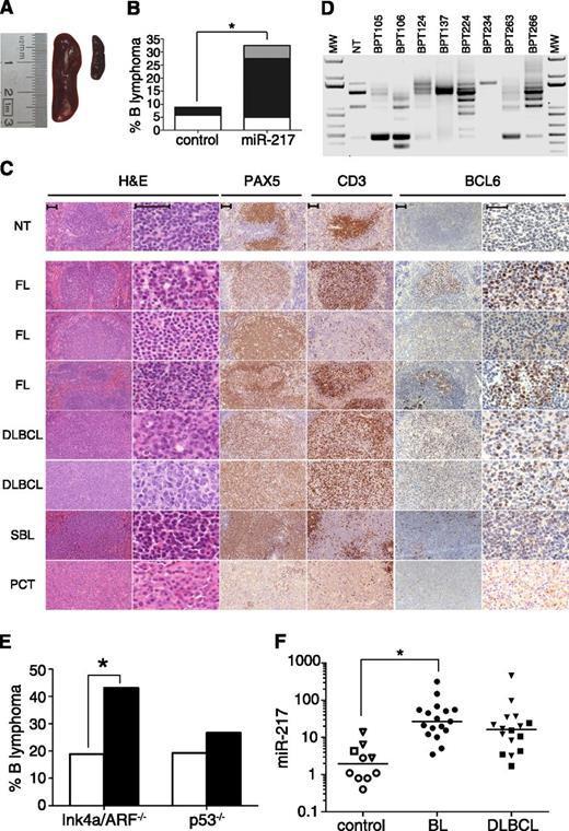 Figure 6. miR-217 expression promotes mature B-cell lymphomas. (A-D) Thirty-four control and 40 miR-217KI mice were monitored over 90 weeks for the appearance of B-cell lymphoma. (A) Representative pictures of (right) a nontumoral control spleen and (left) a miR-217KI spleen with splenomegaly. (B) Quantification of B-cell lymphoma incidence in control mice and miR-217KI mice. The proportions of FL (black), DLBCL (white), or other lymphomas (gray) are shown. Statistical significance was determined by 2-tailed Student t test (P = .028). (C) Representative hematoxilin and eosin (H&E) and immunohistochemical stainings for Pax5, CD3, and Bcl-6 in spleens from miR-217KI mice with B-cell lymphomas. Scale bar is 50 μm. NT, nontumoral; SBL, small B-cell lymphoma. (D) PCR analysis of V(D)J rearrangements in tumor samples from miR-217KI mice. DNA was isolated from total spleen and amplified using a V-degenerate primer in combination with an antisense primer downstream of JH4. Sequencing results are shown in Table 2. Mouse IDs are shown. MW, molecular weight marker. (E) Quantification of B-cell lymphoma incidence in control (open bars) and miR-217KI (filled bars) Ink4a/Arf−/− and p53−/− mice. Statistical significance was determined by 2-tailed Student t test (P = .03 in miR217KI Ink4a/Arf−/− vs control Ink4a/Arf−/− and P = .33 in miR217KI p53−/− vs control p53−/−). (F) miR-217 relative expression in human control samples (open circles, peripheral blood CD19+ B cells; open squares, tonsils; open triangles, lymph nodes), in BL samples (closed circles) and in DLBCL samples (closed triangles, GC B GCB-DLBCL; closed squares, activated B cell, ABC-DLBCL) as determined by qRT-PCR. Statistical significance was determined by 2-tailed Student t test (P = .05 for BL).