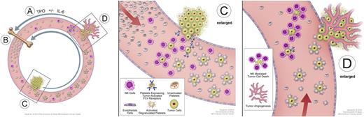 Figure 1. Model of a “vicious cycle” of cooperation between platelets and tumors. (A) Tumors stimulate TPO production, usually indirectly by their elaboration of IL-6 or other cytokines; (B) bone marrow responds to TPO stimulation by increasing platelet production and release into the circulation; (C) circulating platelets are activated either by direct contact with tumor cells via tumor-activated Fcγ receptors or indirectly through the generation of the potent platelet agonist thrombin in the tumor microenvironment (not shown), and in turn, activated platelets that are attracted to the site of tumor stick to and provide a “protective cloak” for circulating tumor cells, shielding them from immune destruction by natural killer cells (C enlarged); and (D) platelets further facilitate metastasis by augmenting circulating tumor cell extravasation. Platelets can also promote metastatic tumor growth by releasing proangiogenic proteins, including vascular endothelial growth factor (not shown), thereby stimulating tumor angiogenesis. The positive-feedback loop is completed as the platelet-assisted growing tumors secrete more TPO-stimulatory cytokines (D enlarged).