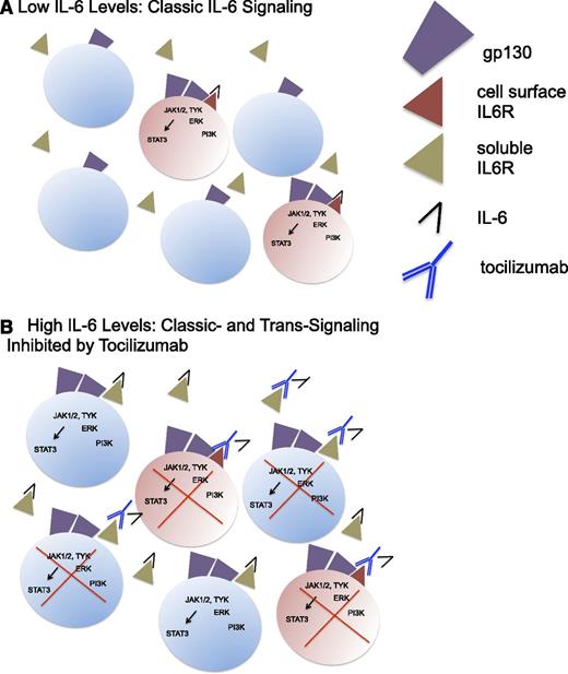 Figure 1. IL-6 signaling and inhibition by tocilizumab. (A) Classic IL-6 signaling restricted to IL-6R–expressing cells shown in pink (macrophages, neutrophils, T cells, and hepatocytes), which predominates when IL-6 levels are low. IL-6 binds to cell-associated IL-6R, leading to homodimerization of gp130 and initiation of downstream pathways. (B) Both classic and trans-IL-6 signaling, which occurs when IL-6 levels are elevated, leading to IL-6 signaling on a broad array of cells, because gp130 is ubiquitously expressed. Tocilizumab binding to both cell-associated IL-6R and soluble IL-6R inhibits classic and trans-signaling. IL-6R–expressing cells are shown in pink, whereas non-IL-6R–expressing cells are shown in blue.