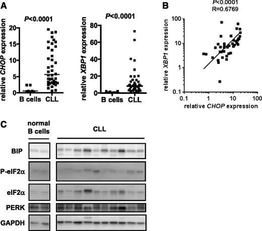 Figure 1. Expression of UPR components in unstimulated CLL samples and normal B cells. (A) CHOP and XBP1 RNA expression was quantified by qPCR in CLL samples (n = 40) and normal B cells (n = 7). Expression values were normalized so that the average value in normal B cells was set to 1.0. Graphs show median and individual data points, and the statistical significance of differences between CLL samples and normal B cells (Mann-Whitney test). (B) Correlation between CHOP and XBP1 RNA expression in CLL samples. The line shows results of linear regression, and the statistical significance of the correlation is shown (Spearman correlation). (C) Immunoblot analysis of BIP, total and phospho-eIF2α, PERK, and glyceraldehyde-3-phosphate dehydrogenase (loading control) in normal B cells (2 preparations shown) and CLL samples. Results shown are representative of >30 samples studied across a series of separate immunoblots.