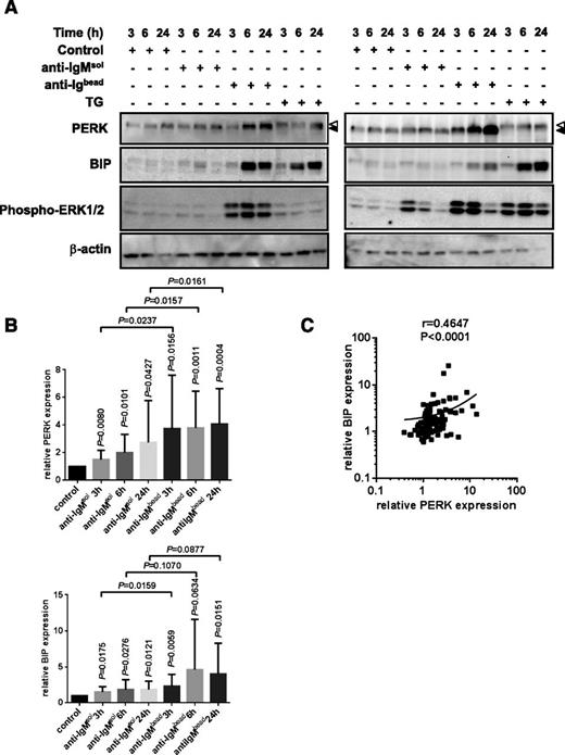 Figure 5. Regulation of BIP and PERK expression by anti-IgM. CLL samples (n = 15) were stimulated with soluble (sol) or bead-bound (bead) anti-IgM or thapsigargin as a control (TG; 15 μM) for up to 24 hours, and expression of PERK, BIP, and phosphorylated ERK1/2 was analyzed by immunoblotting. (A) Representative results from 2 CLL samples. Phosphorylated and nonphosphorylated forms of PERK are indicated by white and black triangles, respectively. (B) Quantitation of results. Expression values were normalized so that the average value in control cells at each time point was set to 1.0, and graphs show mean values (±standard deviation). The statistical significance of differences is shown. Vertical values show the P values for difference between that condition and control cells, whereas horizontal values show P values for the differences between soluble and bead-bound anti-IgM–treated samples at each time point (paired Student t test). (C) Correlation between fold induction of PERK and BIP in soluble/bead-bound anti-IgM–treated CLL samples (3-, 6-, and 24-hour data combined; linear regression and Spearman correlation shown).