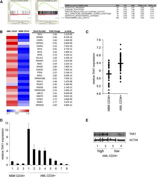Figure 1. TAK1 expression is increased in AML CD34+ cell vs NBM CD34+ cells. (A) Gene set enrichment analysis profiles generated from the AML CD34+ vs NBM CD34+ gene list.22 (B) There were 25 most significantly upregulated apoptosis-associated genes in AML CD34+ cells vs NBM CD34+ cells. (C) Relative expression of TAK1 in all individual AML CD34+ and NBM CD34+ samples analyzed by gene profiling. (D) Relative expression of TAK1 AML CD34+ and NBM CD34+ cells by using quantitative polymerase chain reaction. (E) Relative protein levels of TAK1 in 2 AML CD34+ cells expressing high RNA levels of TAK1 and 2 AML CD34+ cells expressing low RNA levels of TAK1. ES, enrichment score; FDR, false discovery rate; GSEA, gene set enrichment analysis; NES, normalized enrichment score; NOM, nominal P value.