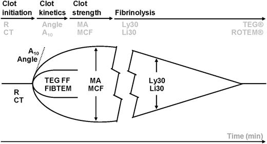 Figure 1. Whole blood is incubated at 37°C in a heated cup in which a suspended pin is connected to a detector system (a torsion wire in TEG and an optical detector in ROTEM). The cup and pin are oscillated relative to each other through an angle of 4° 45′. The movement is initiated from either the cup (TEG) or the pin (ROTEM). As fibrin strands forms between the cup and pin, the transmitted rotation from the cup to pin (TEG) or the impedance of the rotation of the pin (ROTEM) are detected at the pin, and a trace is generated. The trace is divided into parts that reflect different stages of the hemostatic process (clotting time, kinetics, strength, and lysis) with slightly different nomenclature for TEG and ROTEM.22 TEG and ROTEM parameters in the different phases of clot initiation, amplification, propagation, and degradation. TEG: R, reaction time (minutes); angle (degrees); MA, maximum amplitude (mm); Ly30, amplitude reduction after 30 minutes as an indicator of hyperfibrinolysis (%). ROTEM: CT, clotting time (seconds); A10, amplitude after 10 minutes (mm); MCF, maximum clot firmness (mm); Li30, amplitude reduction after 30 minutes as an indicator of hyperfibrinolysis (%). TEG functional fibrinogen maximal amplitude (mm). ROTEM FIBTEM (mm).