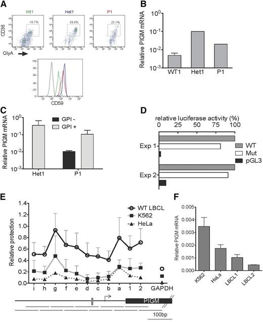 Figure 1. PIGM transcription and chromatin accessibility in erythroid and B cells. (A) Fluorescence-activated cell sorter analysis of cell-surface expression of CD59 in primary erythroid precursor cells from a normal wild-type (WT) donor (green), heterozygous (Het1; blue) parent, and patient with IGD (P1; red). Erythroid precursor cells were generated from peripheral blood mononuclear cells, and flow cytometric analysis was performed on day 7 of the culture. Histograms show CD59 expression on erythroid precursors identified as CD36+GlyA+ cells (upper panel). Gray line: isotypic control. (B) PIGM mRNA expression in normal, Het1, and P1 primary erythroid precursor cells. PIGM mRNA levels were assessed by quantitative reverse-transcription polymerase chain reaction (qRT-PCR) in flow-sorted CD36+GlyA+ erythroid precursor cells as shown in (A). Data were normalized to GAPDH. Het1 and P1, n = 1; normal, n = 4. (C) PIGM mRNA expression in Het1 and P1 B cells. PIGM mRNA levels were assessed by qRT-PCR in sorted primary CD19+GPI+ and CD19+GPI− B cells (see supplemental Figure 1A). GPI expression was assessed after staining with flourescent aerolysin. Note that heterozygous B cells are all GPI+ . Data were normalized to GAPDH. Het1, n = 2; P1, n = 2. (D) WT and mutated (Mut) PIGM promoter transcriptional activity in vitro. Luciferase reporter assays were performed in K562 cells. Cell lysates were assayed for luminescence 48 hours after transfection. Luminescence values were normalized to renilla, and results are presented relative to the activity of the WT promoter construct. pGL3 represents a promoter-less control construct. Mean values of 2 independent experiments, each performed in triplicate assays, are shown. (E) Nucleosome mapping by MNase protection assay at the length of the PIGM promoter in WT LBCL, HeLa, and K562 cells. The abundance of eleven 100-bp amplicons that overlap by 50 bp (shown below the graph) was quantified by quantitative polymerase chain reaction using equal amounts of MNase-digested or undigested DNA, as described the supplemental Methods. The gray box indicates the −270GC-rich box. Letters represent amplicons upstream of the transcription start site (TSS; shown as an arrow), whereas numbers denote regions downstream of the TSS. (F) PIGM mRNA expression in 2 WT LBCL, HeLa, and K562 cells. PIGM mRNA levels were assessed by qRT-PCR. Data were normalized to GAPDH and are shown as mean ± standard error of the mean (n = 3).